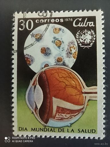 Куба 1976 медицина
