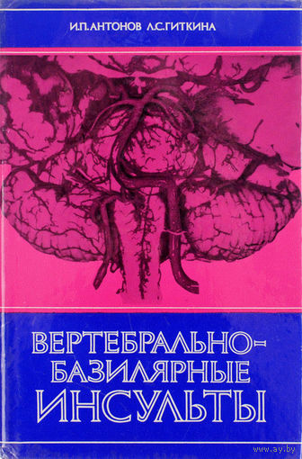 Антонов. Вертебрально-базилярные инсульты