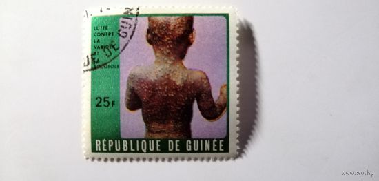 Гвинея 1970. Кампания против кори и оспы