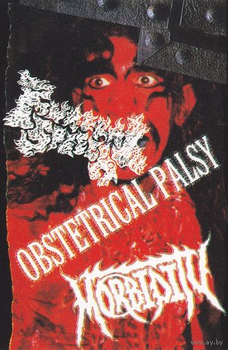 Funeral Speech / Obstetrical Palsy / Morbidity "Bloody Deeds / Natural Selection / Humans Foolishness Is Limitless" кассета